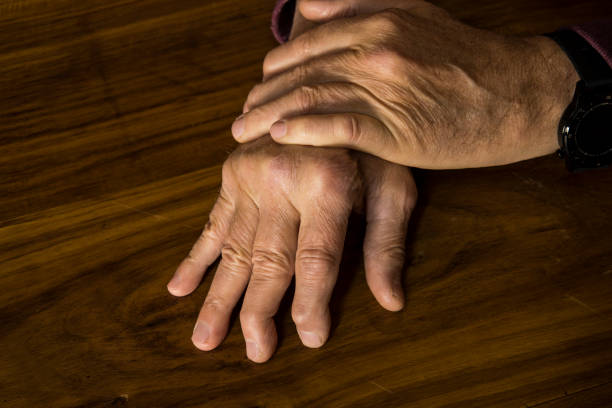 Avoiding These Pitfalls Can Improve Your Psoriatic Arthritis Symptoms