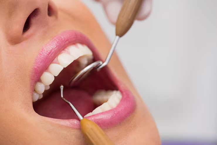 What Fort Worth Residents Should Know Before Choosing Cosmetic Dental Work